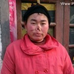 این دختر چینی لب و دماغش توسط موش خورده شد